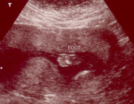 A Foot!